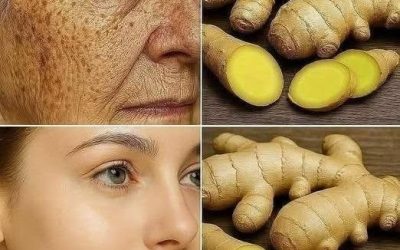 Ingefära är 100 gånger effektivare än Botox på att eliminera djupa rynkor, fräknar och missfärgningar. Jag måste säga något så att du kan fortsätta få mina recept… Tack!