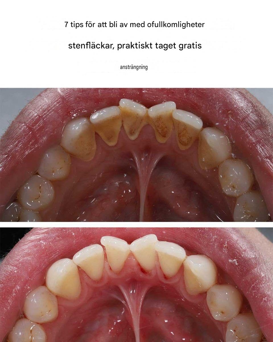 7 tips för att enkelt ta bort fula fläckar från sten.