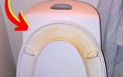 Hur man tar bort gula fläckar från en toalettstol