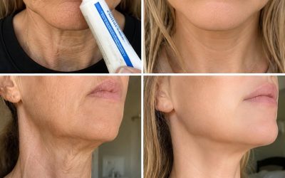 ”Det ser ut som om jag har genomgått plastikkirurgi”: Husmedel som används för att förbättra utseendet på rynkor och mörka fläckar på händer och armar. För att fortsätta få mina recept behöver du bara säga… Tack!