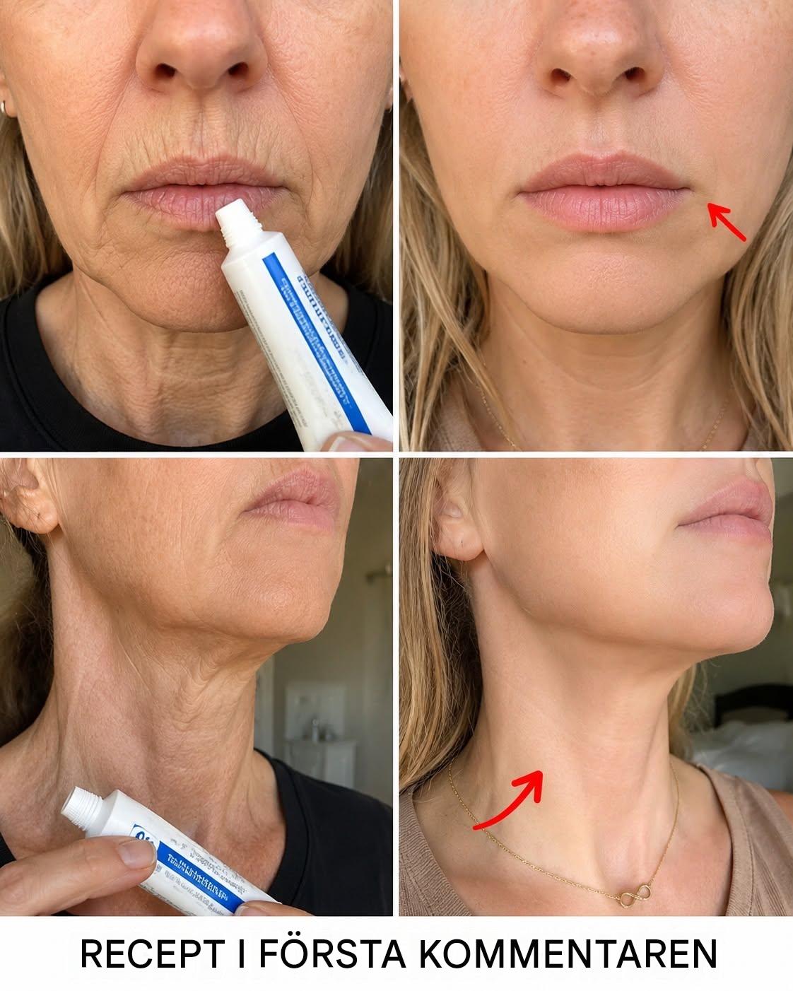 ”Det ser ut som om jag har genomgått plastikkirurgi”: Husmedel som används för att förbättra utseendet på rynkor och mörka fläckar på händer och armar. För att fortsätta få mina recept behöver du bara säga… Tack!