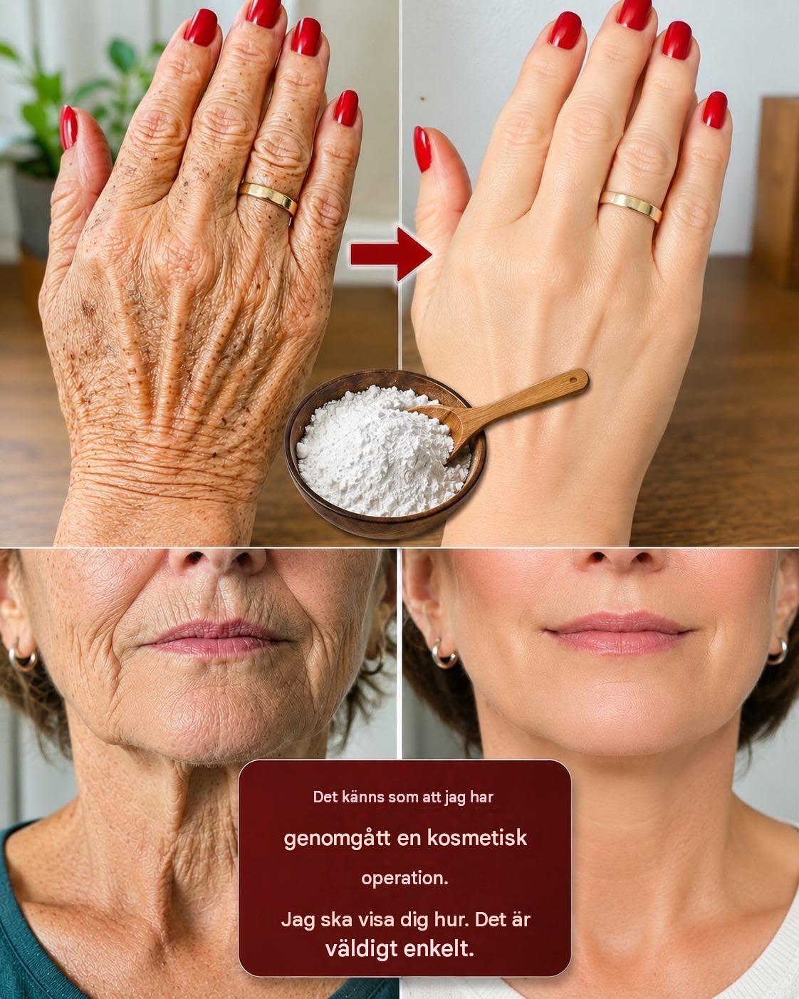 “Jag ser ut som om jag genomgått plastikkirurgi”: Ett hemmagjort sätt att förbättra utseendet på rynkor och deformationer på mina händer och axlar. För att fortsätta få mina recept, säg bara… Tack!