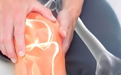 Bukspottkörtelcancer: 4 varningstecken i benen som inte bör ignoreras (1/2)