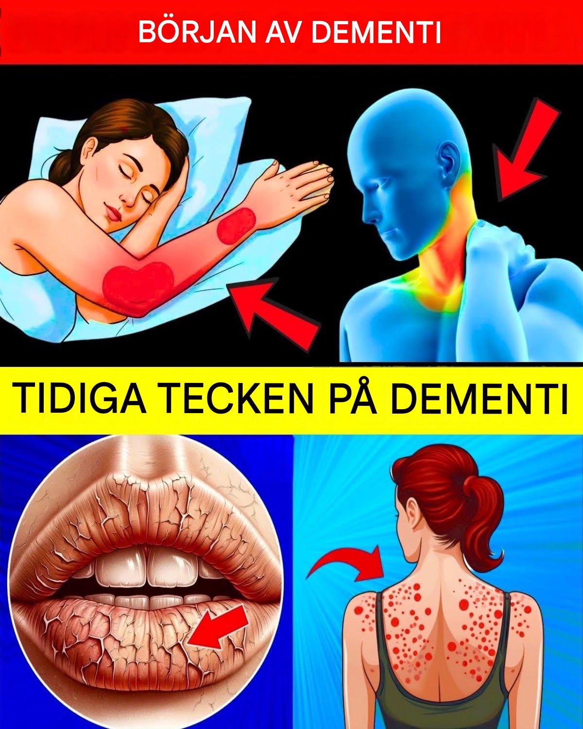 10 tidiga tecken på demens som du aldrig bör ignorera!