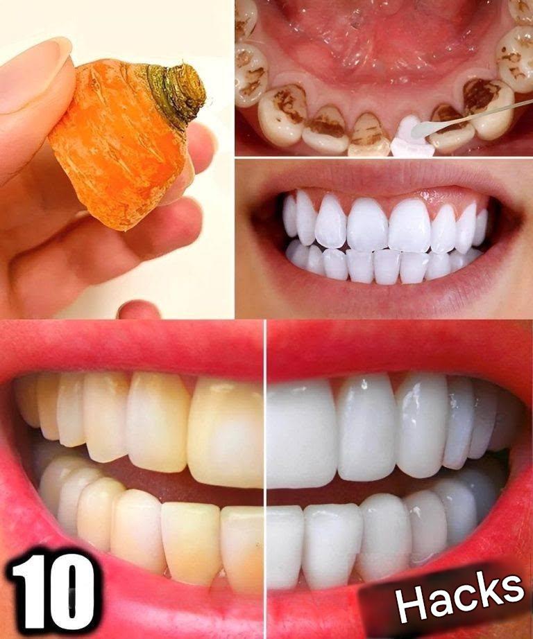 10 naturliga knep för att bleka tänderna hemma på bara 3 dagar (ingen tandläkare behövs)